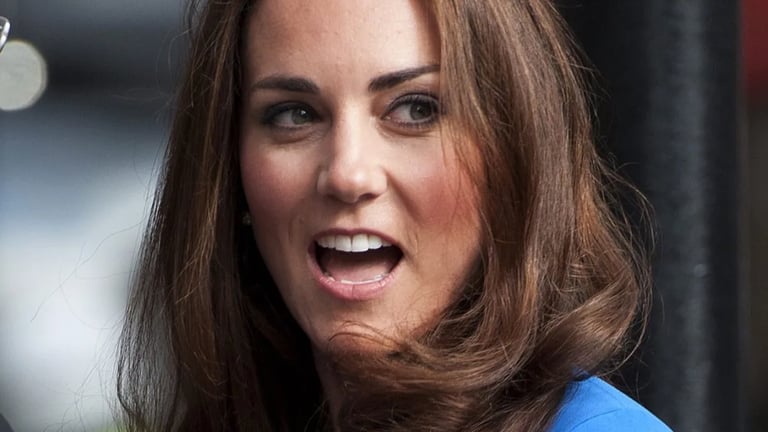 Kate Middleton, il suo segreto di bellezza è veleno d'api