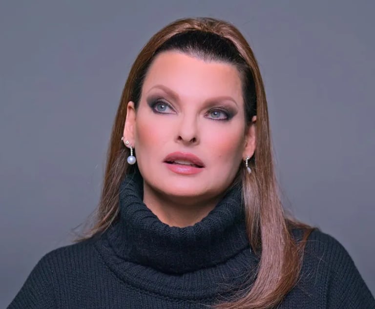 Linda Evangelista: nessun senso di colpa per il trattamento che l’ha sfigurata